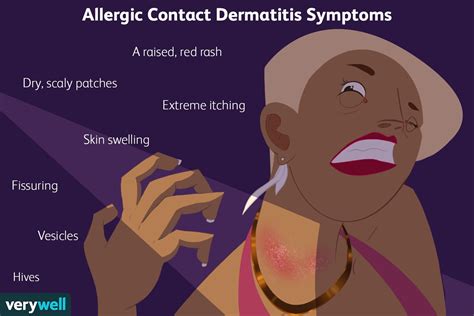 Allergic Contact Dermatitis: Symptoms, Causes, and Treatment