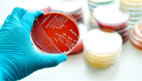 What Are Agar Slants? | Sciencing