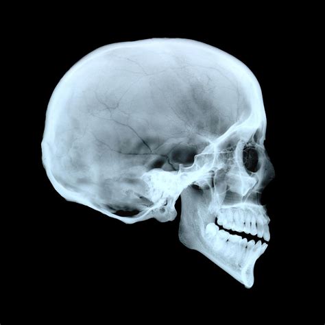 Adult Human Skull Photograph by D. Roberts