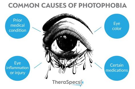 What does photophobia feel like? - 27F Chilean Way