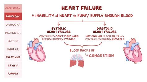 Pathophysiology Of Acute And Chronic Right Heart Fail - vrogue.co