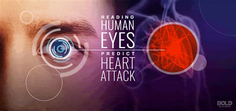 Google Retina Scan Can Read Your Eyes to Predict Heart Attacks