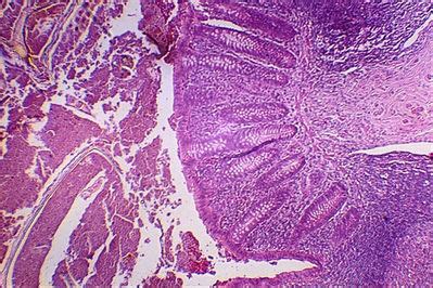 Appendix Histology - Appendix - histology slide