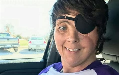 Kentucky woman disfigured in firework accident recalls 'devastating ...