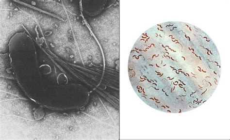 Vibrio Cholerae Cell Structure