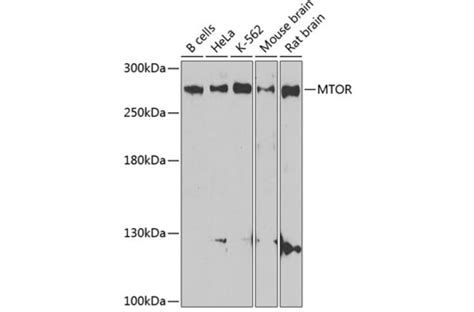 Anti-mTOR Antibody (A80535) | Antibodies.com