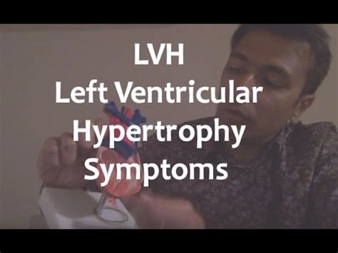 Left Ventricular Hypertrophy (LVH): Prevalence, Risk Factors And ...