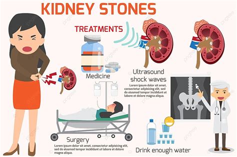 Detail Medical Set Elements And Symptoms With Treatment Of Kidney Stone Infographics Template ...