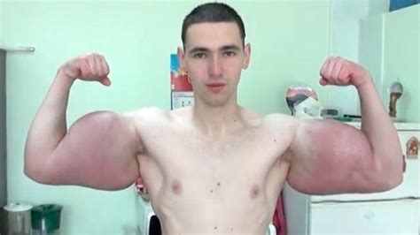 Meet The Russian Guy Who Makes And Injects His Own Synthol