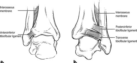 Ankle Syndesmosis Injuries - Physiopedia