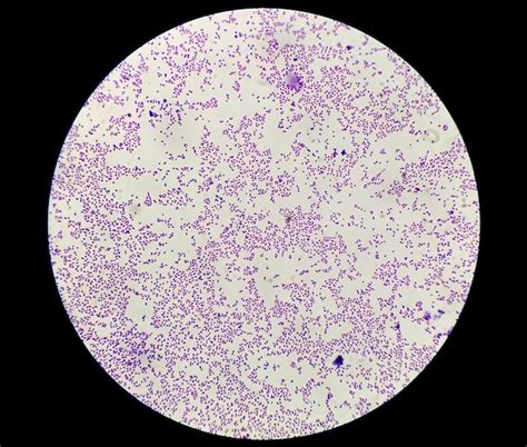 Staphylococcus Epidermidis Gram Stain