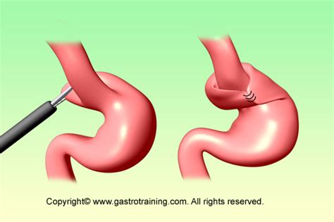 Gastroenterology Education and CPD for trainees and specialists ...