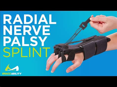 Radial Nerve Palsy Splint | Dynamic Wrist Drop & Finger Extension Brace