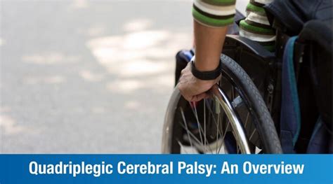 Quadriplegic Cerebral Palsy | Causes, Symptoms and Treatment