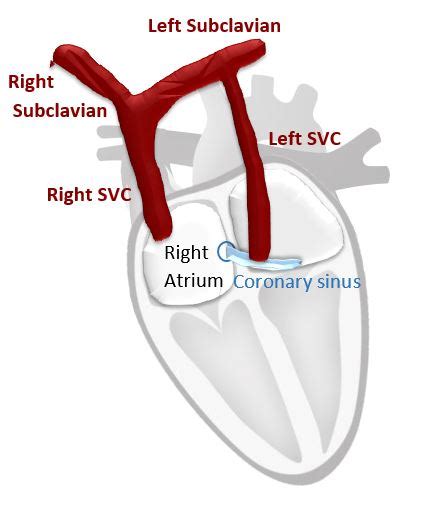 CardioServ Blog Cardioserv