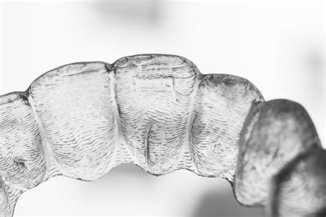 What to Expect From the Invisalign® Process - TAG Dental Clinic