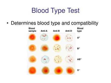 PPT - Blood Typing Lab PowerPoint Presentation, free download - ID:6594760