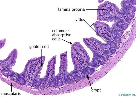 Ileum - Google Search | Small intestine histology, Histology slides ...