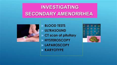 SECONDARY AMENORRHEA investigation & diagnosis - YouTube