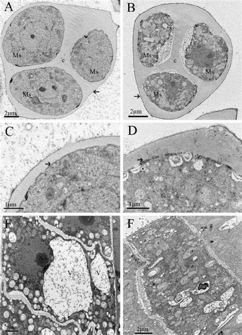 Ultrastructural structure of cross-sections of anthers of RC 7 and B7 ...