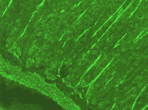 Anti-smooth muscle antibodies (ASMA) positive control - Launch Diagnostics