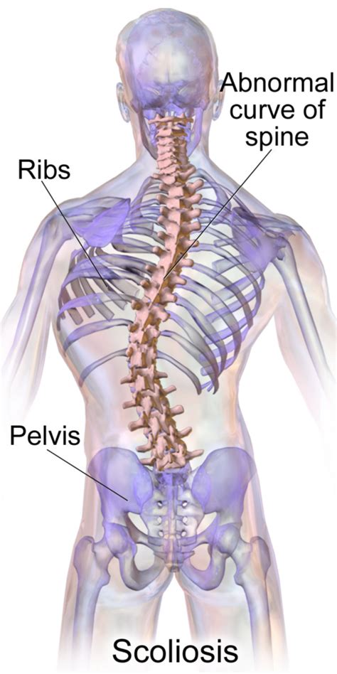 Scoliosis Screening & Treatment in Forked River | Monmouth Pain