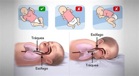 El Dr. Héctor Badellino nos explica qué es la muerte súbita en un bebé - Radio Estación