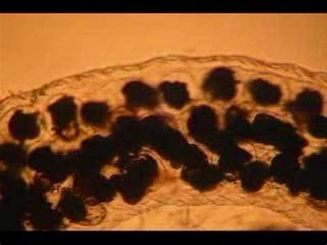 Berghia Nudibranch Eggs 2 weeks old - YouTube