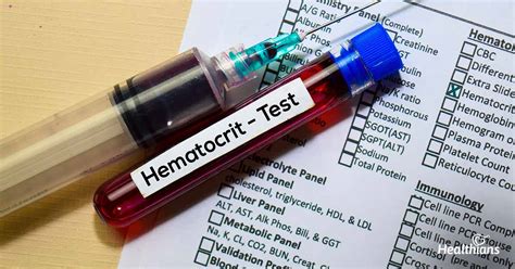 PCV Hematocrit Test – The Need And The Meaning Of Results