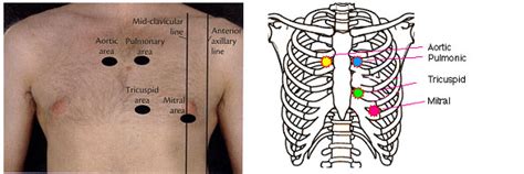 rijalqaryah: SpecIfic CVS examination