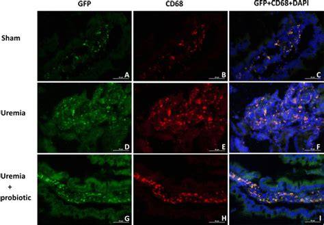 Immunofluorescence of macrophages (CD68, red signal) together with the ...