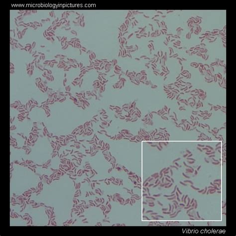 Vibrio cholerae. Gram stain and cell morphology. Vibrio cholerae ...