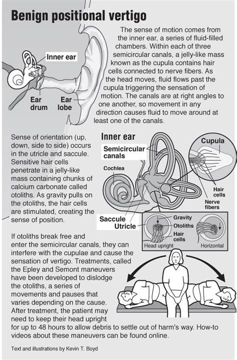 Natural Tinnitus Remedies To Stop The Ringing | Vertigo, Vertigo treatment, Tinnitus remedies