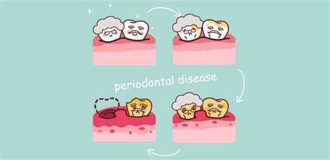 Periodontal Disease Stages: Available Treatments & Future Outlook | Triple Bristle