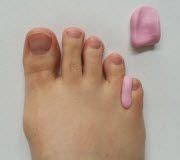 How To Prevent Blisters Between Toes & Pinch Blisters | Blister Prevention | Toe blister ...