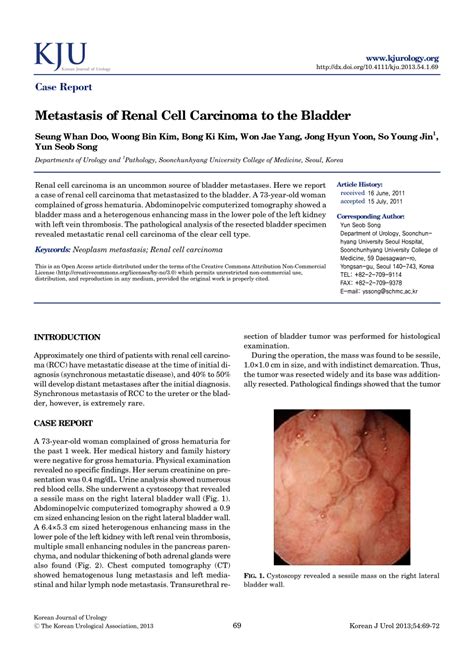 Full article: Metastasis of Renal Cell Carcinoma to the Bladder