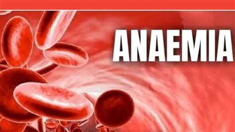 Anaemia in children: Common and uncommon causes, symptoms, treatment in India | Health ...
