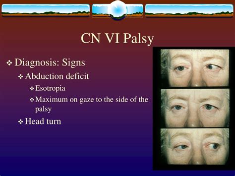 PPT - Clinical Case Challenges In Neuro-Optometry III PowerPoint ...