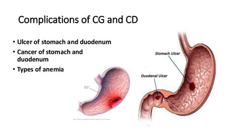 Chronic gastritis and duodenitis