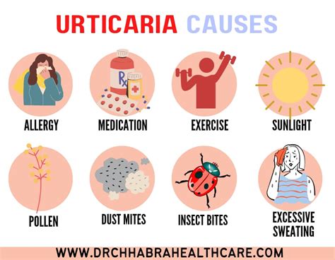 Urticaria - Symptoms, Treatment & Causes - Dr. Chhabra