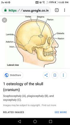 Junctions on skull: bregma, lambda, asterion, pterion | Skull | Anatomy bones, Anatomy, Dentistry