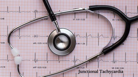 Junctional Tachycardia - Meaning, Types, Causes, Symptoms, Prevention & Treatment - Helthy Leaf