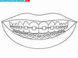 How To Draw Braces  Easy Drawing Tutorial For Kids sketch template