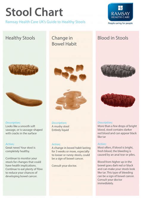 Best Blood Stool Cancer of all time The ultimate guide | stoolz