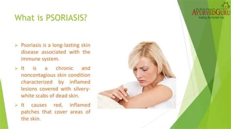 PPT - Psoriasis Treatment Market Size, Outlook 2024 PowerPoint Presentation - ID:12893214