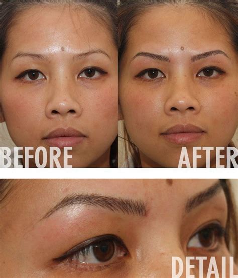 The Best Eyebrow Tattoo Removal Options Ideas - clowncoloringpages