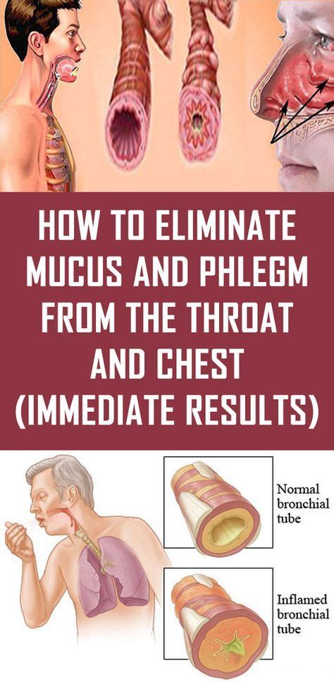 How to Eliminate Mucus and Phlegm from the Throat and Chest (Immediate ...