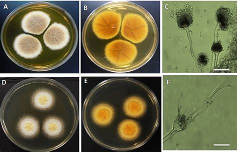 Aspergillus Nidulans Morphology