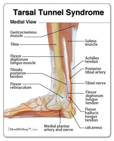 11 best tarsal tunnel images on Pinterest | Physical therapy, Tarsal tunnel syndrome and Foot pain