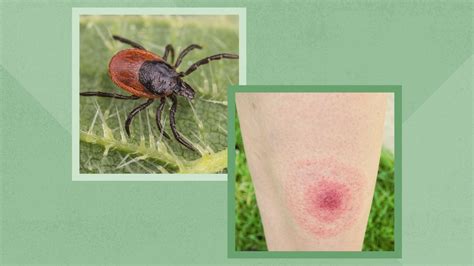 Can Ticks Make Dogs Sick